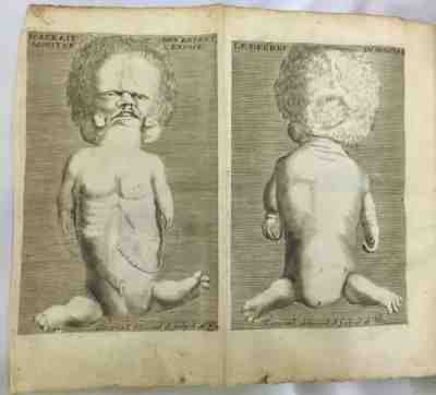 Human Monsters Medical Surgical Book Scultet, L'Arcenal de chirurgie 1712