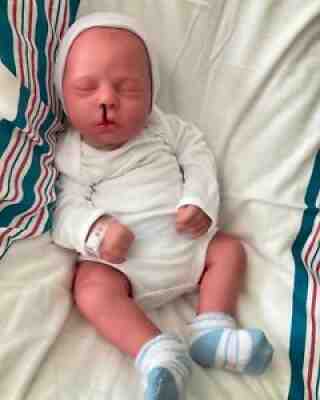 realborn dustin cleft lip cleft palate reborn baby doll